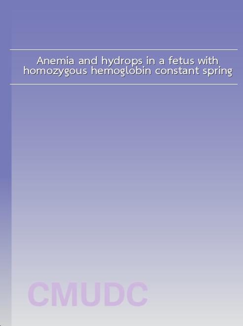 Anemia and hydrops in a fetus with homozygous hemoglobin constant spring book